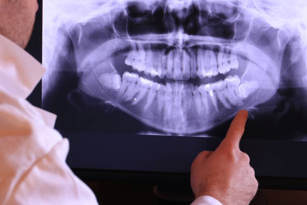 Best Cracked Tooth Emergency Dentist  in Sanger, TX