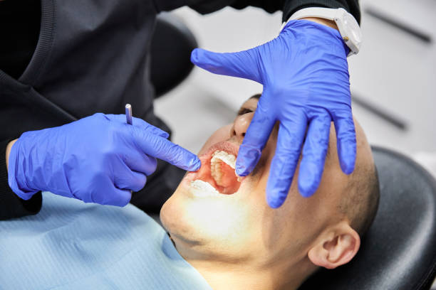 Best Dentist for Tooth Abscess  in Sanger, TX